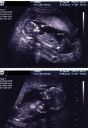 Filename=molly.jpg
Filesize=62KiB
Dimensions=454x656
Date added=Jun 09, 2024 molly.jpg